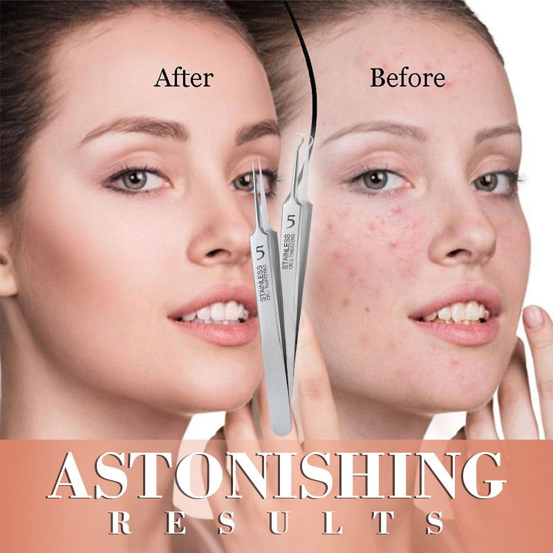 Specialised tweezers for beauty salo