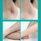 🎁Painless Full Body Hair Removal Cream 💧✨（The more you buy, the higher the discount）